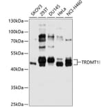 Western Blot - Anti-Dnmt2 Antibody (A11330) - Antibodies.com