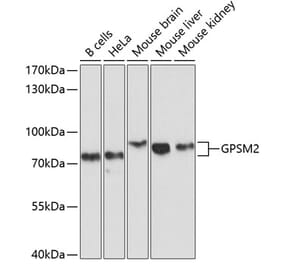 Western Blot - Anti-LGN Antibody (A11332) - Antibodies.com
