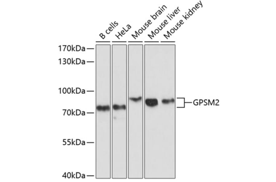 Western Blot - Anti-LGN Antibody (A11332) - Antibodies.com