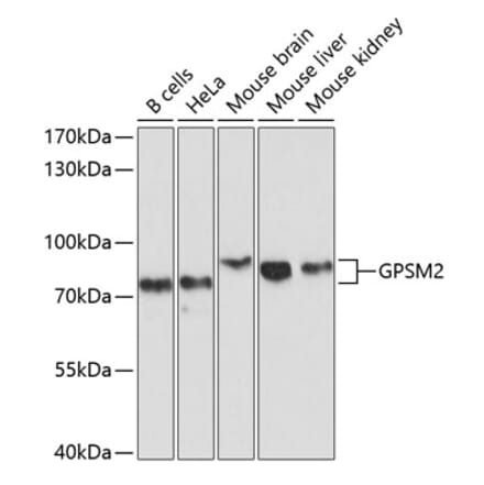 Western Blot - Anti-LGN Antibody (A11332) - Antibodies.com