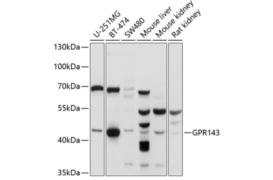 Western Blot - Anti-GPR143 Antibody (A11333) - Antibodies.com