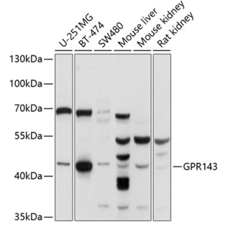 Western Blot - Anti-GPR143 Antibody (A11333) - Antibodies.com