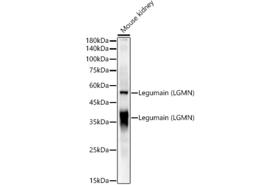 Western Blot - Anti-Legumain Antibody (A11334) - Antibodies.com