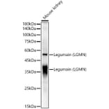 Western Blot - Anti-Legumain Antibody (A11334) - Antibodies.com