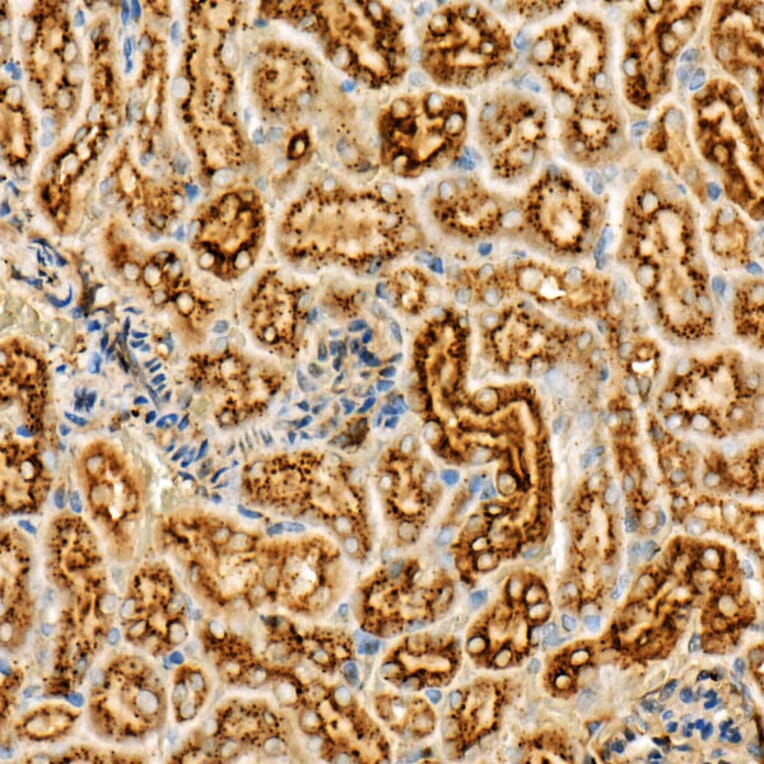 Immunohistochemistry - Anti-Legumain Antibody (A11334) - Antibodies.com