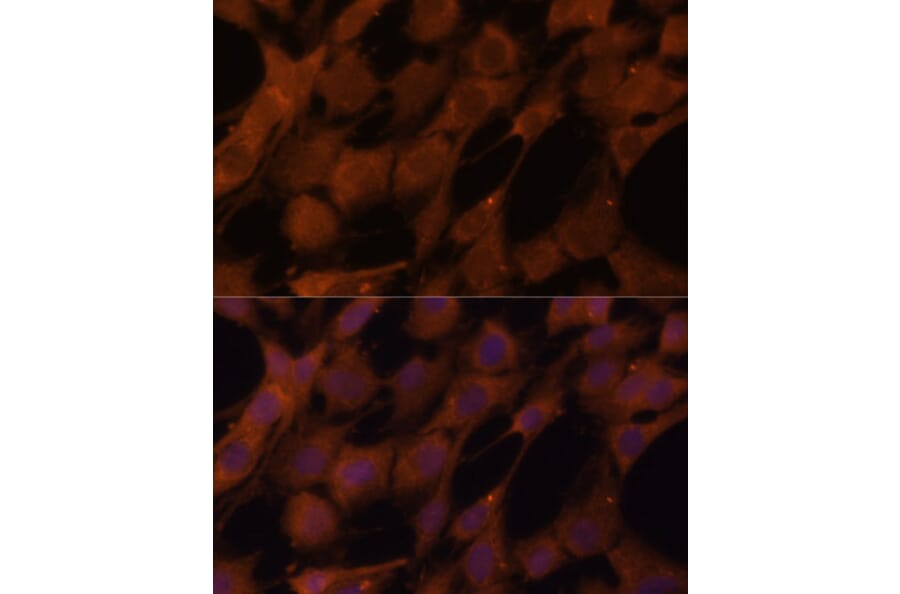 Immunofluorescence - Anti-Legumain Antibody (A11334) - Antibodies.com
