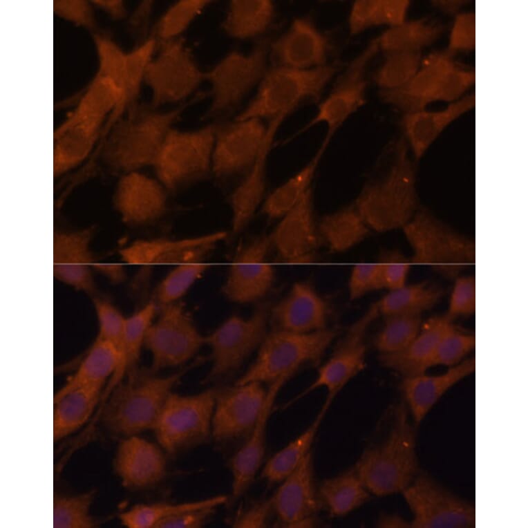 Immunofluorescence - Anti-Legumain Antibody (A11334) - Antibodies.com