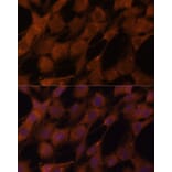 Immunofluorescence - Anti-Legumain Antibody (A11334) - Antibodies.com