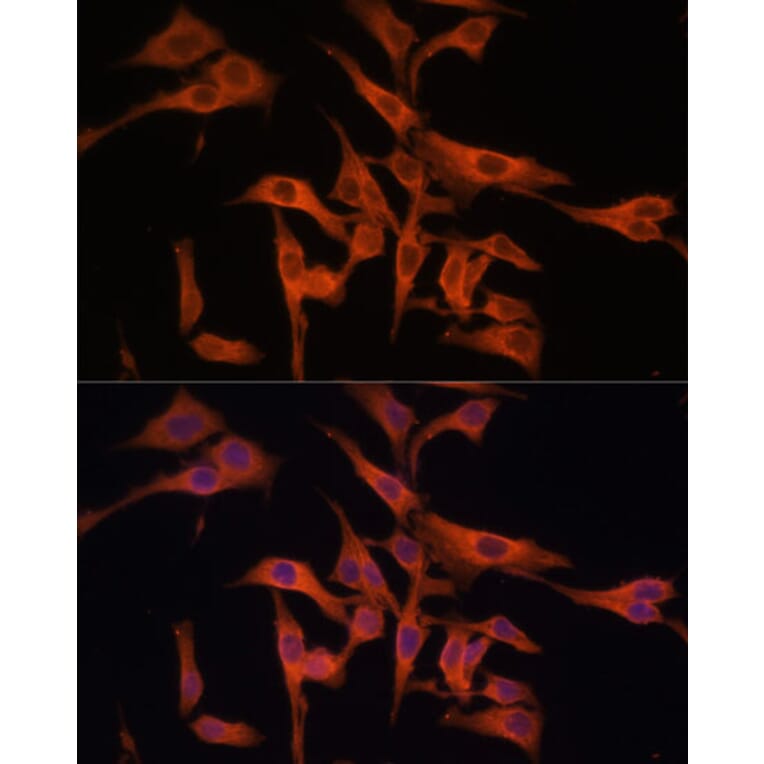 Immunofluorescence - Anti-Legumain Antibody (A11334) - Antibodies.com