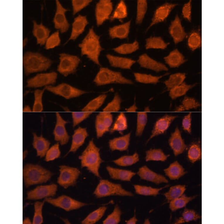 Immunofluorescence - Anti-Legumain Antibody (A11334) - Antibodies.com