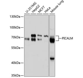 Western Blot - Anti-PICALM Antibody (A11335) - Antibodies.com