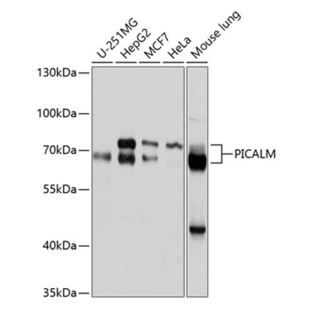 Western Blot - Anti-PICALM Antibody (A11335) - Antibodies.com