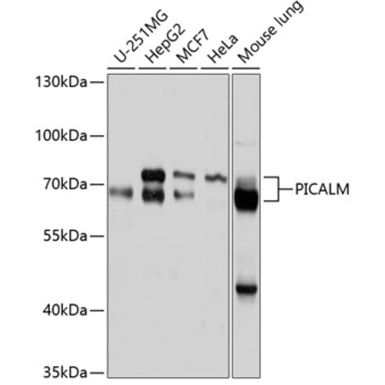 Western Blot - Anti-PICALM Antibody (A11335) - Antibodies.com