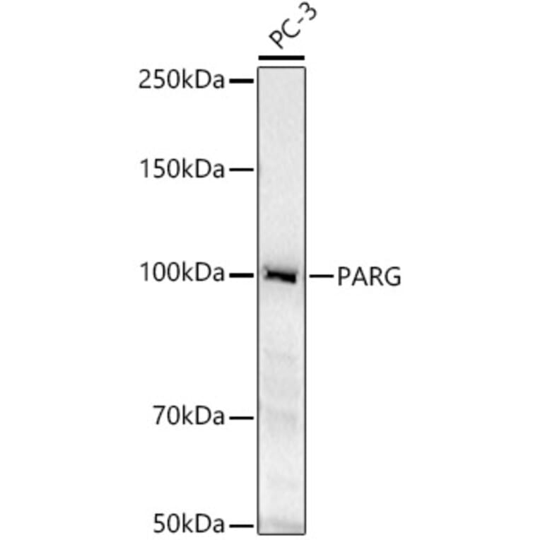 Western Blot - Anti-PARG Antibody (A11336) - Antibodies.com