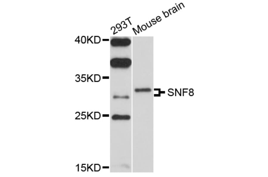 Western Blot - Anti-SNF8 Antibody (A10583) - Antibodies.com