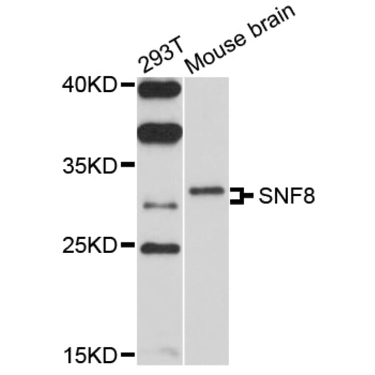 Western Blot - Anti-SNF8 Antibody (A10583) - Antibodies.com