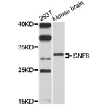Western Blot - Anti-SNF8 Antibody (A10583) - Antibodies.com