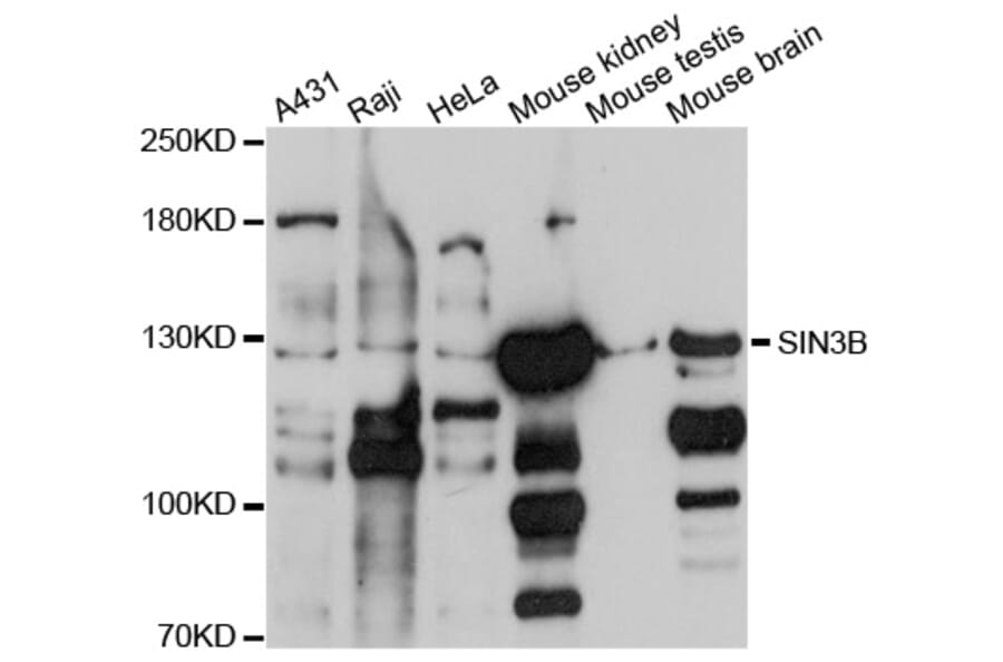 Western Blot - Anti-SIN3B Antibody (A10584) - Antibodies.com