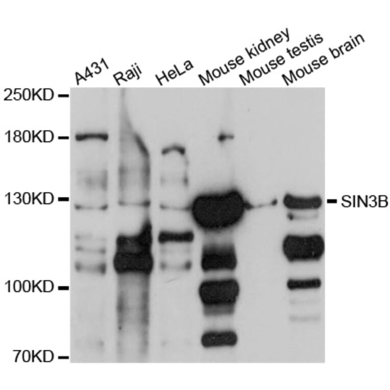 Western Blot - Anti-SIN3B Antibody (A10584) - Antibodies.com