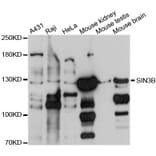 Western Blot - Anti-SIN3B Antibody (A10584) - Antibodies.com