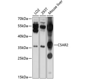 Western Blot - Anti-GPCR C5L2 Antibody (A11340) - Antibodies.com
