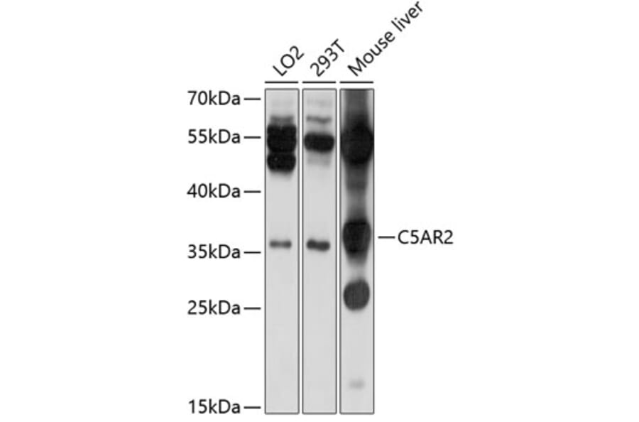 Western Blot - Anti-GPCR C5L2 Antibody (A11340) - Antibodies.com