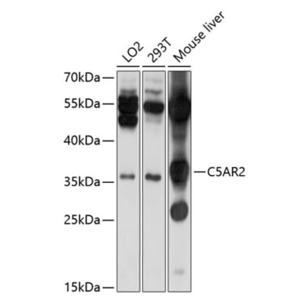 Western Blot - Anti-GPCR C5L2 Antibody (A11340) - Antibodies.com