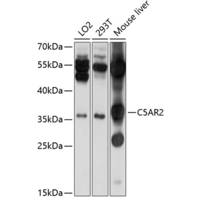 Western Blot - Anti-GPCR C5L2 Antibody (A11340) - Antibodies.com