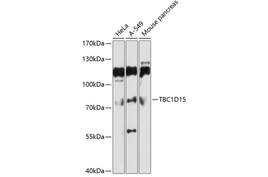Western Blot - Anti-TBC1D15 Antibody (A10593) - Antibodies.com