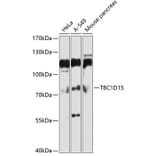 Western Blot - Anti-TBC1D15 Antibody (A10593) - Antibodies.com