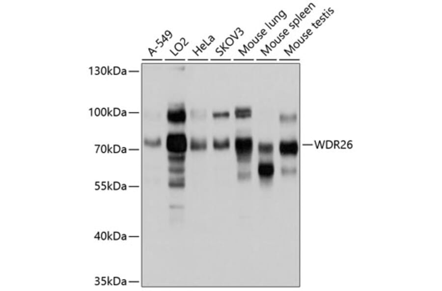 Western Blot - Anti-WDR26 Antibody (A11342) - Antibodies.com