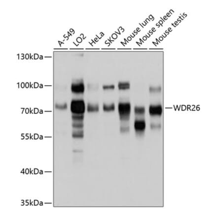 Western Blot - Anti-WDR26 Antibody (A11342) - Antibodies.com