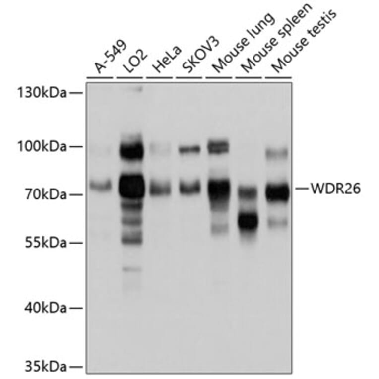 Western Blot - Anti-WDR26 Antibody (A11342) - Antibodies.com