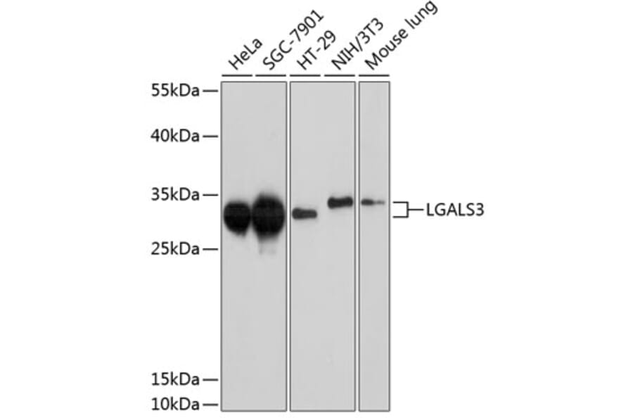Western Blot - Anti-LGALS3 Antibody (A10607) - Antibodies.com