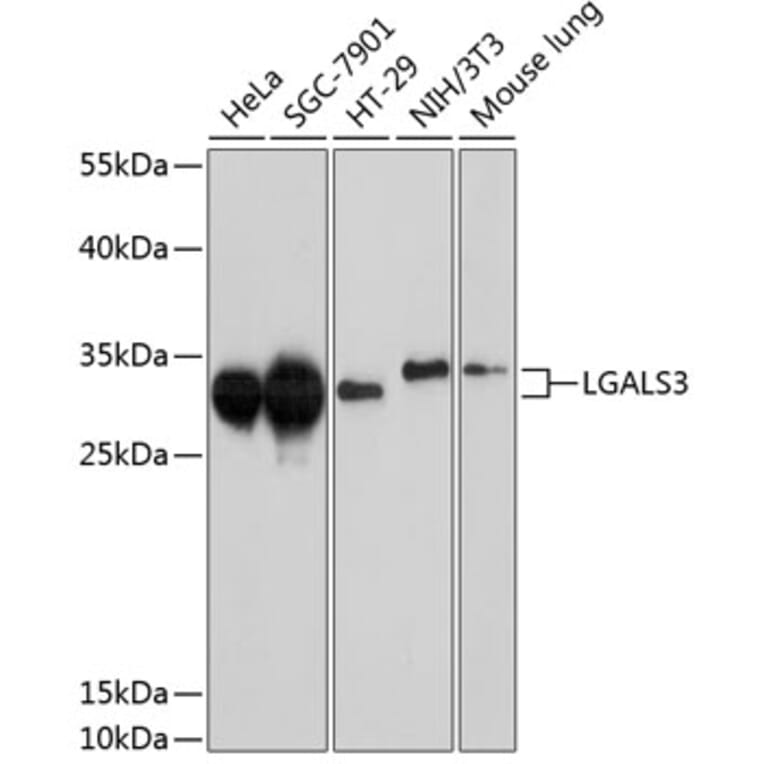 Western Blot - Anti-LGALS3 Antibody (A10607) - Antibodies.com