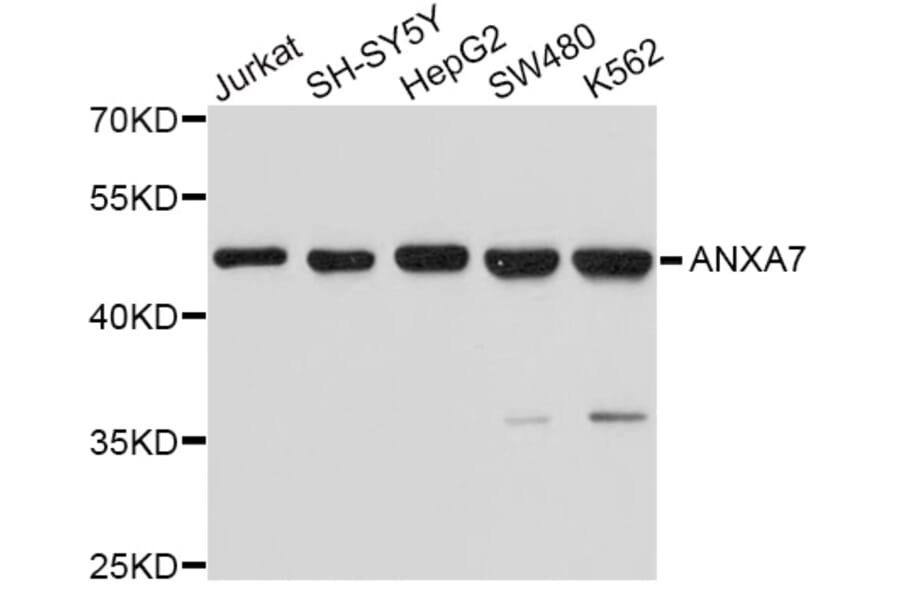 Western Blot - Anti-ANXA7 Antibody (A10752) - Antibodies.com