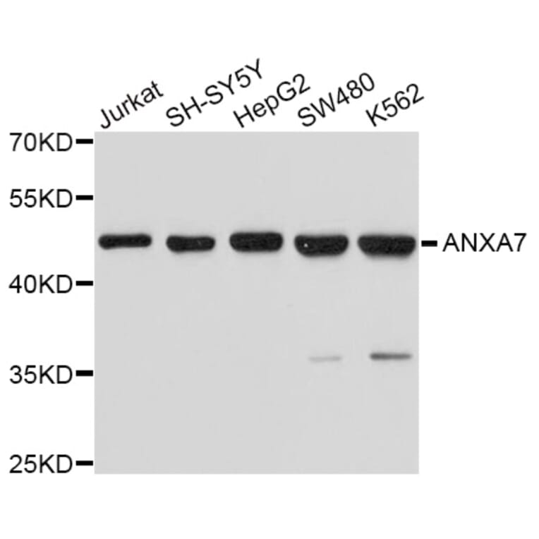 Western Blot - Anti-ANXA7 Antibody (A10752) - Antibodies.com