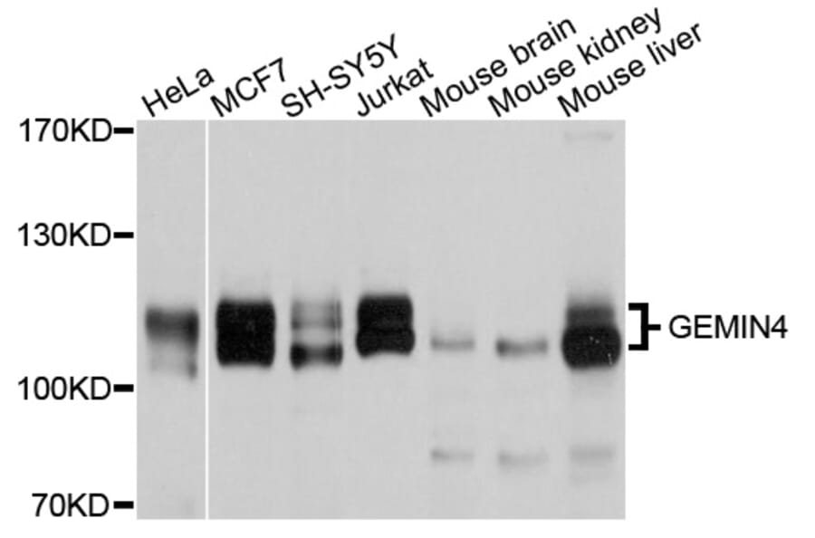 Western Blot - Anti-GEMIN4 Antibody (A10764) - Antibodies.com