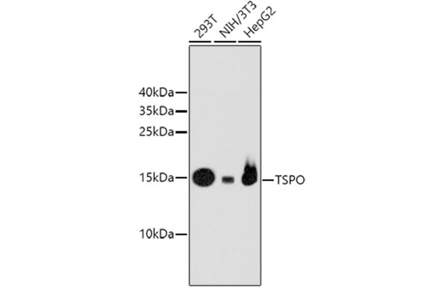 Western Blot - Anti-TSPO Antibody (A10765) - Antibodies.com