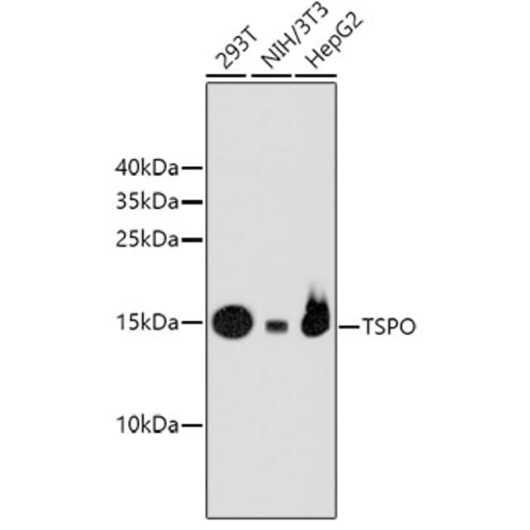 Western Blot - Anti-TSPO Antibody (A10765) - Antibodies.com