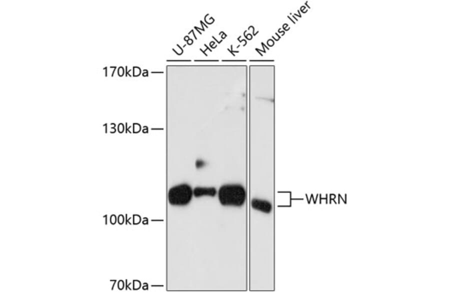 Western Blot - Anti-DFNB31 Antibody (A11350) - Antibodies.com