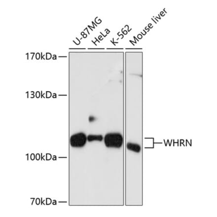 Western Blot - Anti-DFNB31 Antibody (A11350) - Antibodies.com