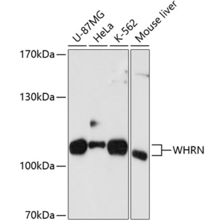 Western Blot - Anti-DFNB31 Antibody (A11350) - Antibodies.com
