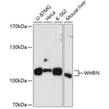 Western Blot - Anti-DFNB31 Antibody (A11350) - Antibodies.com