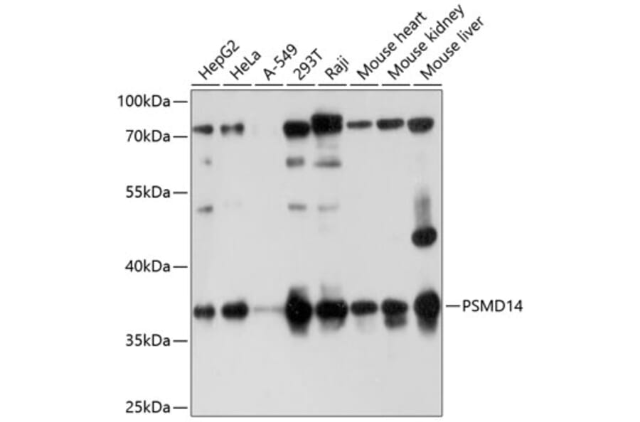 Western Blot - Anti-PSMD14 Antibody (A11351) - Antibodies.com