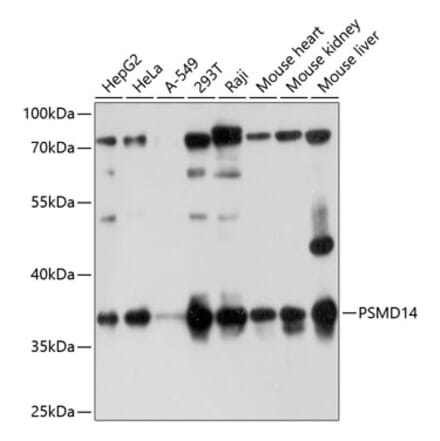 Western Blot - Anti-PSMD14 Antibody (A11351) - Antibodies.com