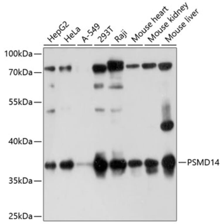 Western Blot - Anti-PSMD14 Antibody (A11351) - Antibodies.com