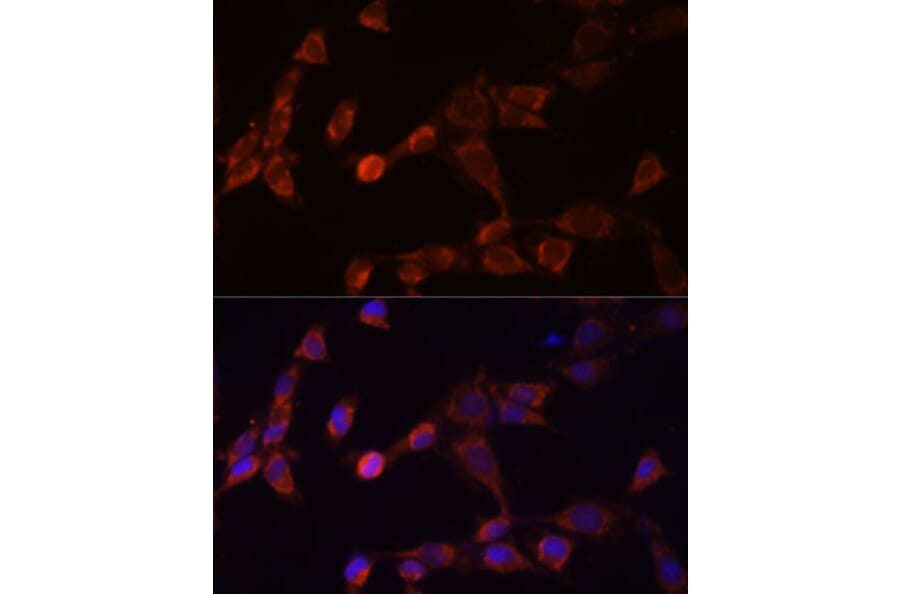 Immunofluorescence - Anti-PSMD14 Antibody (A11351) - Antibodies.com