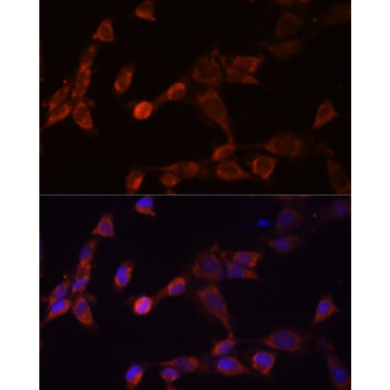 Immunofluorescence - Anti-PSMD14 Antibody (A11351) - Antibodies.com