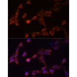 Immunofluorescence - Anti-PSMD14 Antibody (A11351) - Antibodies.com